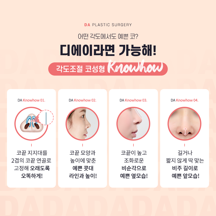 코성형, 개별 맞춤 수술을 위해 알아야 할 것 관련 이미지 6