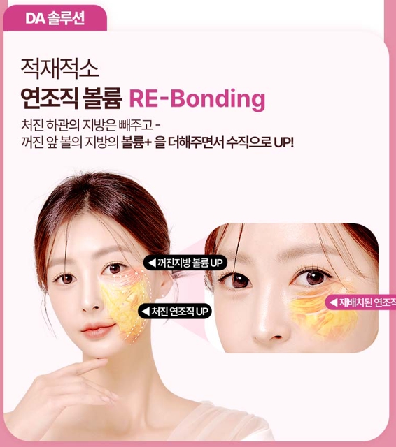 수직미니거상, 자연스러운 리프팅을 원한다면 알아볼 점 관련 이미지 3