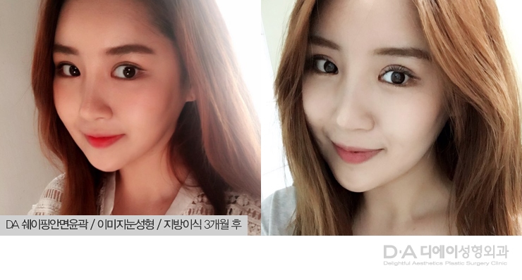 모델스토리 쉐이핑안면윤곽으로 청초한 분위기 여신 관련 이미지 5