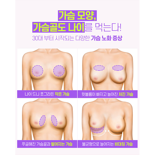 A Complete Guide to Lift Breast Surgery for Improving Breast Sagging image 3