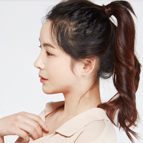 유형별 코성형의 특징과 방법 관련 이미지 26