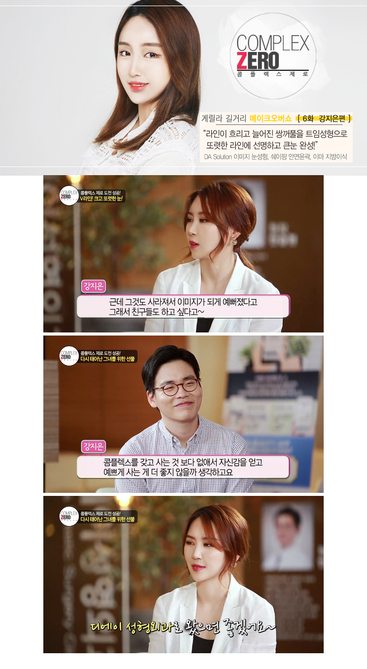 콤플렉스제로 트임성형 끝판왕 강지은 관련 이미지 7