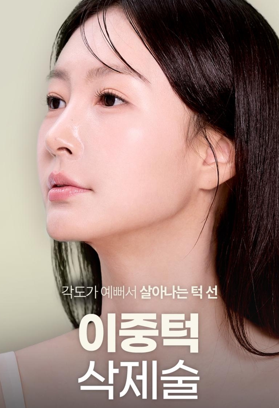 Double Chin Removal Surgery: Essential Information from Effects to Recovery Time image 1