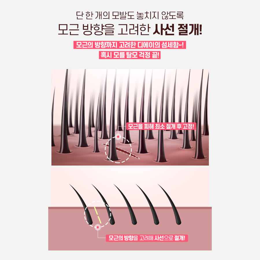 처진얼굴, 탄력개선에 효과적인 시술 방법 관련 이미지 10