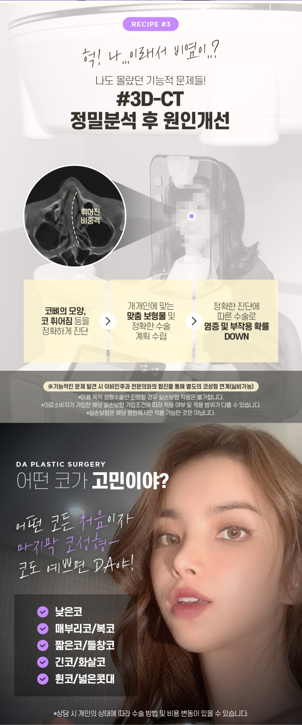 자가연골코성형 알아볼 때 주의사항 관련 이미지 5