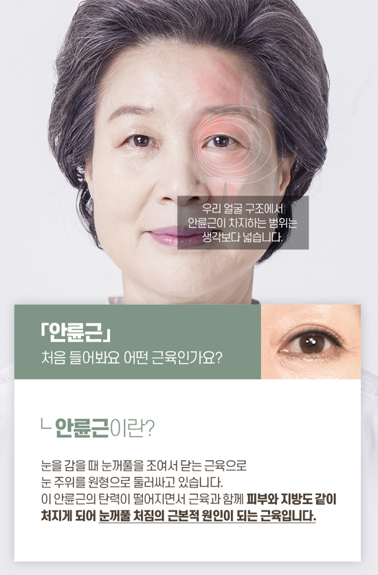 디에이성형외과 중년눈성형, 상안검수술 관련 이미지 4