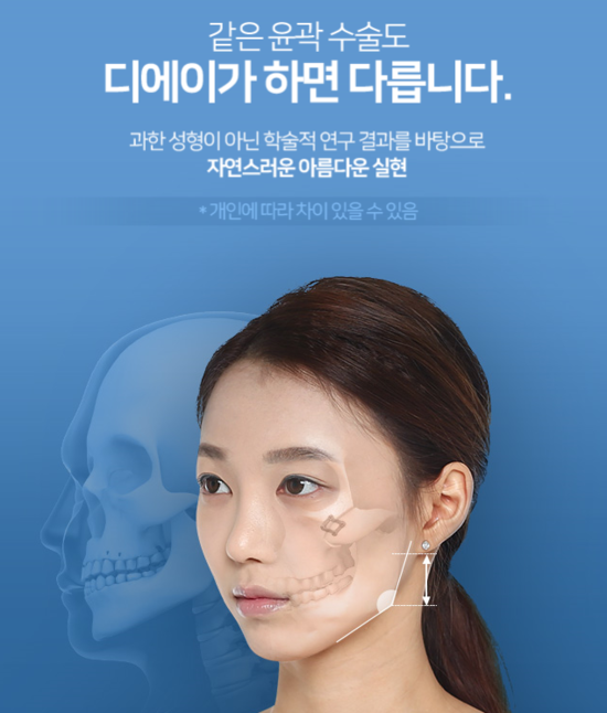 디에이성형외과 안면윤곽, 기본에 집중합니다 관련 이미지 4