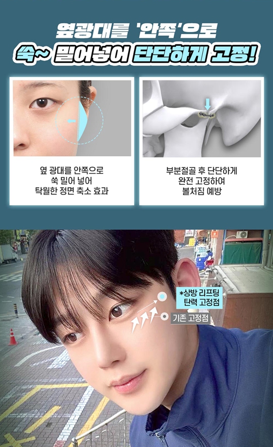 남자광대축소, 얼굴형과 옆광대 돌출을 함께 고려해야 하는 이유 관련 이미지 3