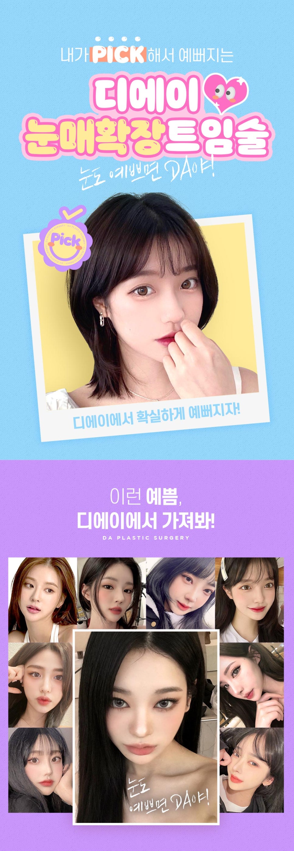 눈매확장트임으로 답답하고 사나운 눈 개선하기 관련 이미지 7