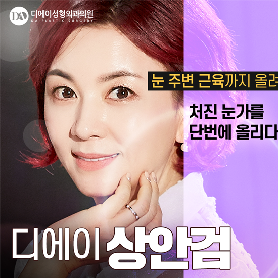 디에이성형외과 중년눈성형, 상안검수술 관련 이미지 2
