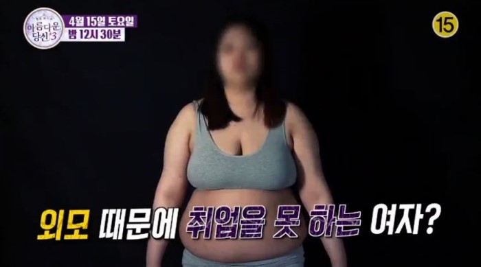 아름다운당신3 X 디에이성형외과와 함께한 첫번째 주인공이 공개됩니다. 관련 이미지 5