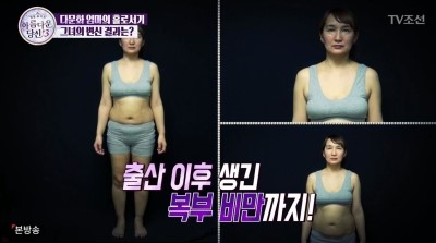아름다운당신3 지나라씨와의 숨겨진 뒷이야기 공개 with 디에이성형외과 관련 이미지 12