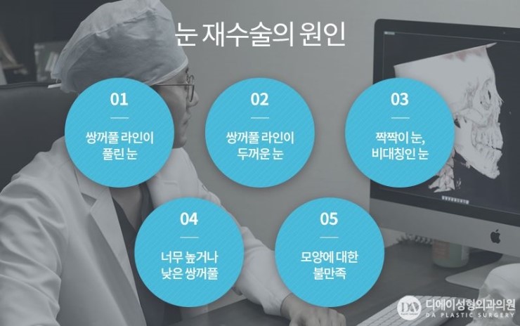가장 많은 재수술로 꼽히는 눈재수술, 그 이유는? 관련 이미지 3