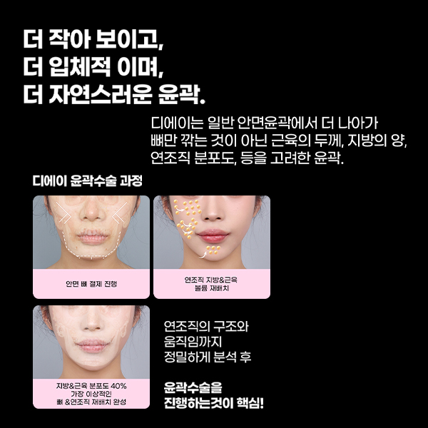 윤곽3종, 많이 깎는다고 예뻐지는 걸까? 관련 이미지 7