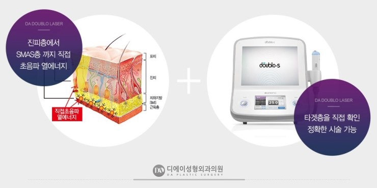 V라인 리프팅 종류 관련 이미지 7