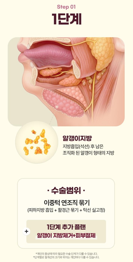 Double Chin Removal Surgery: Essential Information from Effects to Recovery Time image 7
