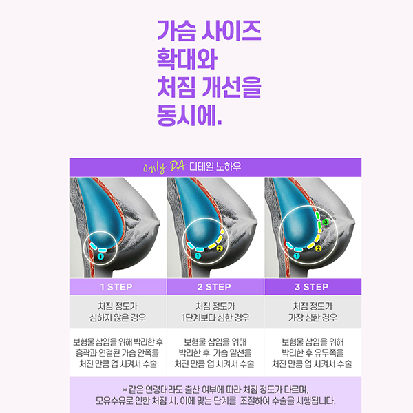 A Complete Guide to Lift Breast Surgery for Improving Breast Sagging image 4