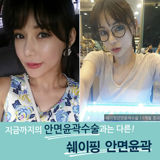 최소 절제, 최상의 효과! DA성형외과 쉐이핑안면윤곽 관련 이미지 7