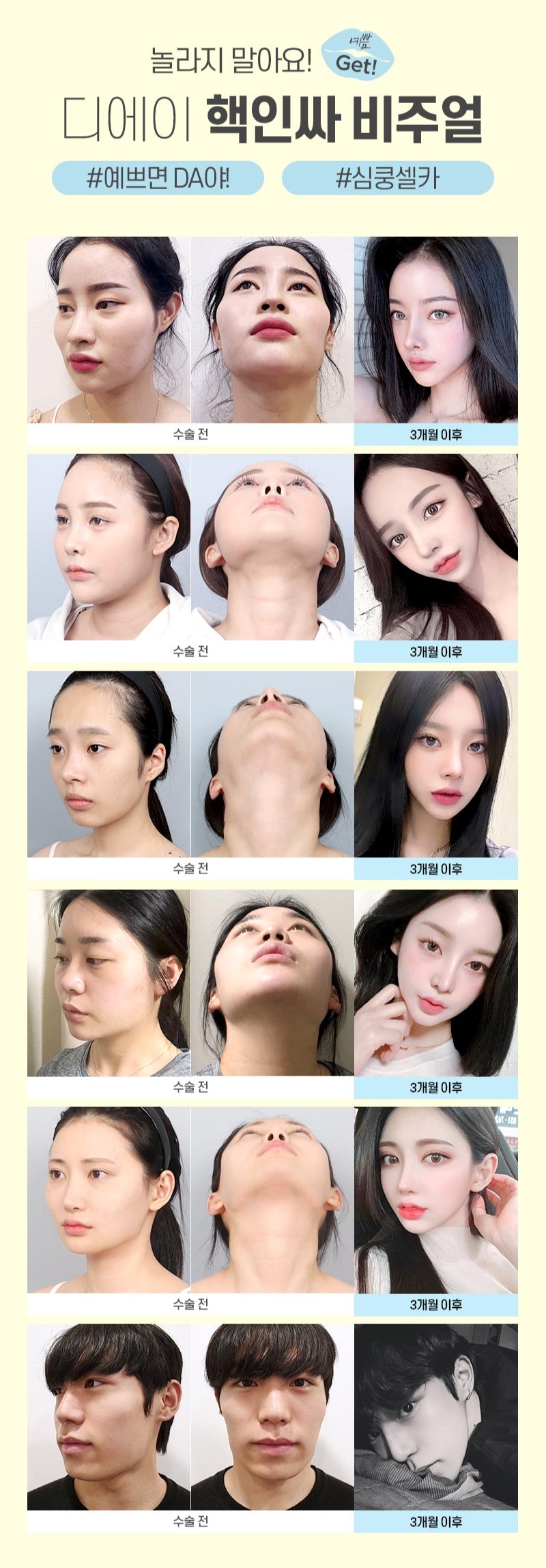 디에이 윤곽3종 | 조화롭고 아름다운 얼굴형을 찾아 관련 이미지 2