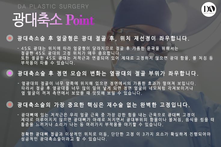 안면윤곽 수술 전 체크사항 관련 이미지 11