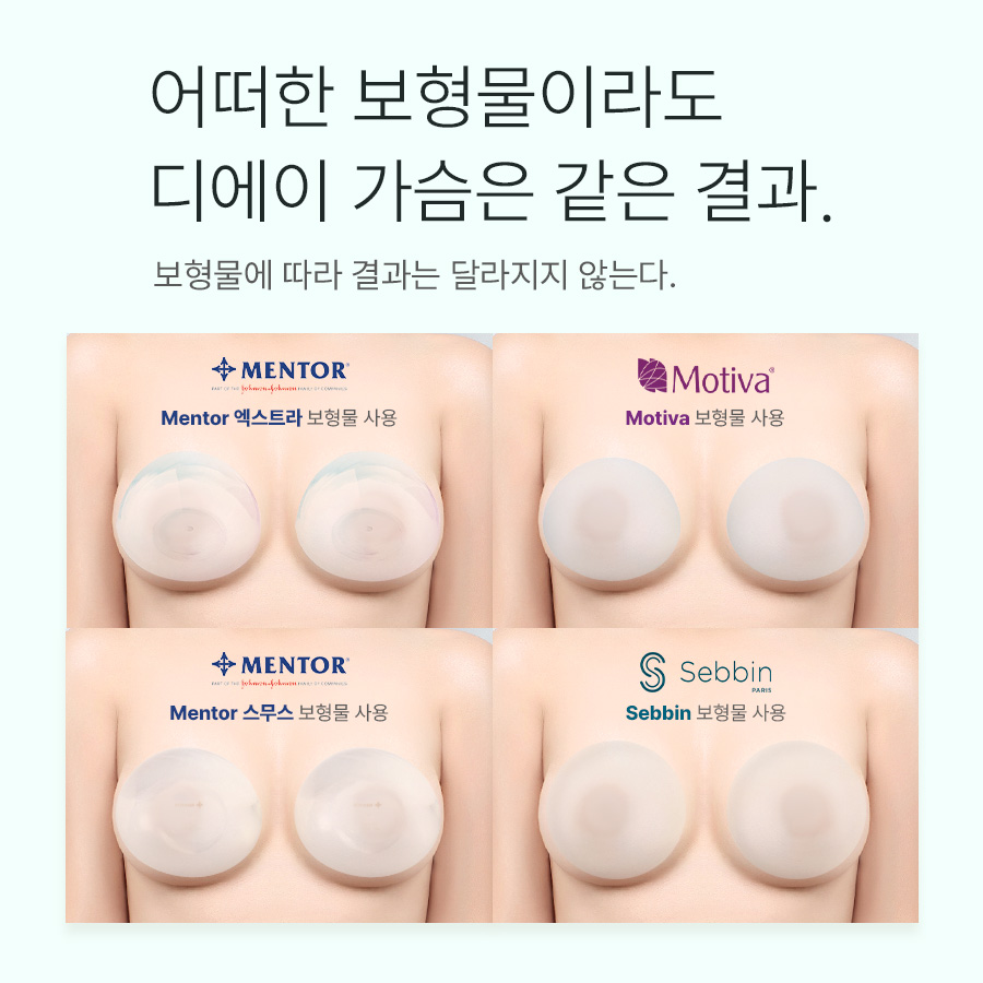나에게 맞는 가슴성형, 체크 리스트 관련 이미지 7