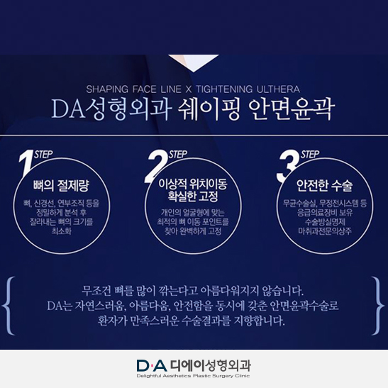DA의 완벽한 안면윤곽, 쉐이핑윤곽수술과 타이트닝 울쎄라로 완성! 관련 이미지 4