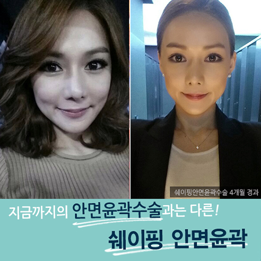 최소 절제, 최상의 효과! DA성형외과 쉐이핑안면윤곽 관련 이미지 3