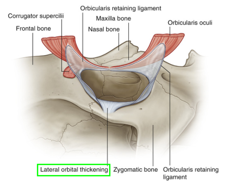 What Type of Plastic Surgery Is Needed for Small, Cramped Eyes? (About Lateral, Lower, and Combined Lateral-Lower Canthoplasty) image 18