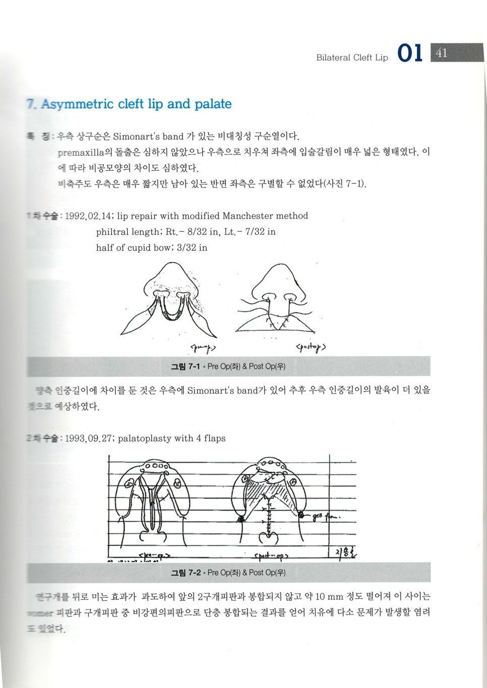 구순열 수술의 대가, 미드라인성형외과의 박병윤 교수님을 소개합니다. 관련 이미지 14