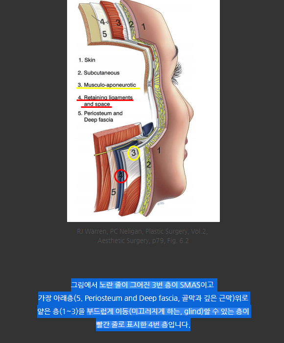 얼굴 주름 리프팅, 오래 지속되고 효과 좋은 수술방법은? 관련 이미지 4