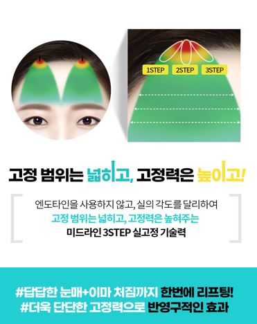 멀티 내시경이마거상술 vs 일반 이마거상술 차이점! 관련 이미지 6
