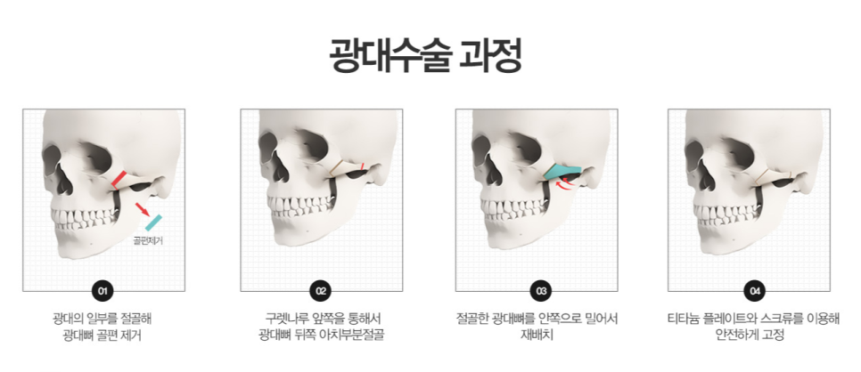 I am Kim Jun-hyun, Chief Director of Midline Plastic Surgery. image 5