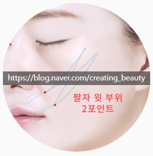 인디언 주름 고민 해결! 중안면부 리프팅에 대하여 설명드립니다. 관련 이미지 12