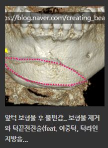 필러&middot;보형물 부작용, 골흡수 됐을 때 해결 방법은? 관련 이미지 9