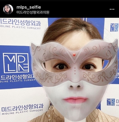 <1편> 쌍꺼풀 수술 없이 눈을 크게 만드는 방법을 성형외과 전문의가 직접 설명드립니다. 관련 이미지 2