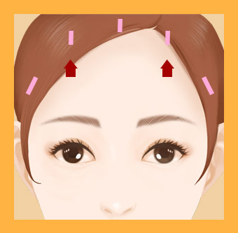 내시경 이마거상(Endoscopic forehead lift)에 대하여 성형외과 전문의가 알려드립니다. 관련 이미지 4