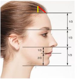 이마축소(forehead reduction)에 관하여 성형외과 전문의가 알려드립니다. 관련 이미지 4