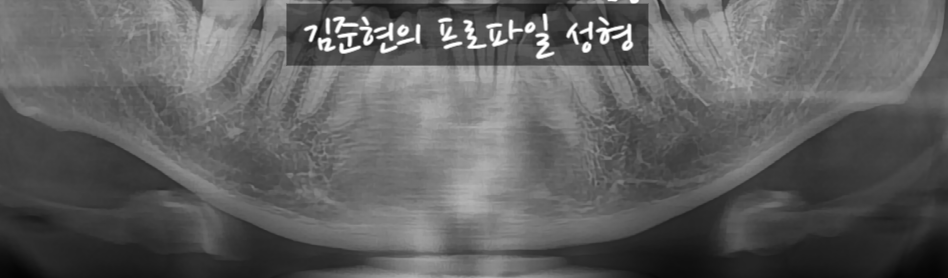 턱끝전진술로 생긴 이차각은 어떻게 되나요?! 관련 이미지 6
