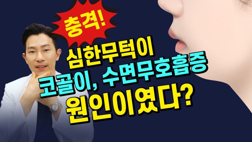 A Plastic Surgeon Explains the Changes in the Front and Side Views After Reduction Genioplasty and Advancement Genioplasty. (Feat. Rhinoplasty) image 16