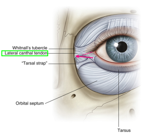What Type of Plastic Surgery Is Needed for Small, Cramped Eyes? (About Lateral, Lower, and Combined Lateral-Lower Canthoplasty) image 17
