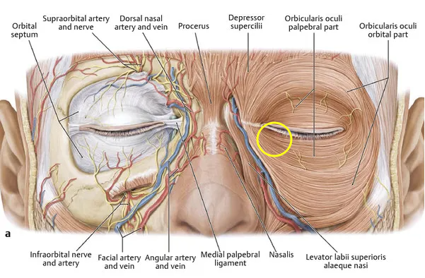 I don’t like bulging under-eye fat, dark circles, or wrinkles under the eyes. I’ll explain the no-touch lower blepharoplasty and fat grafting procedure. image 2