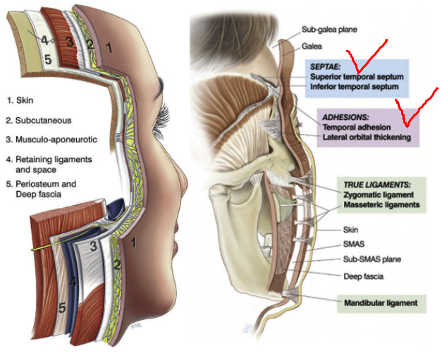 내시경 이마거상(Endoscopic forehead lift)에 대하여 성형외과 전문의가 알려드립니다. 관련 이미지 5