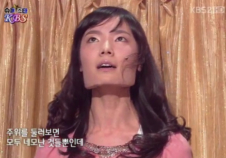 남자 사각턱 수술 효과에 대하여 성형외과 전문의가 설명드립니다. 관련 이미지 3