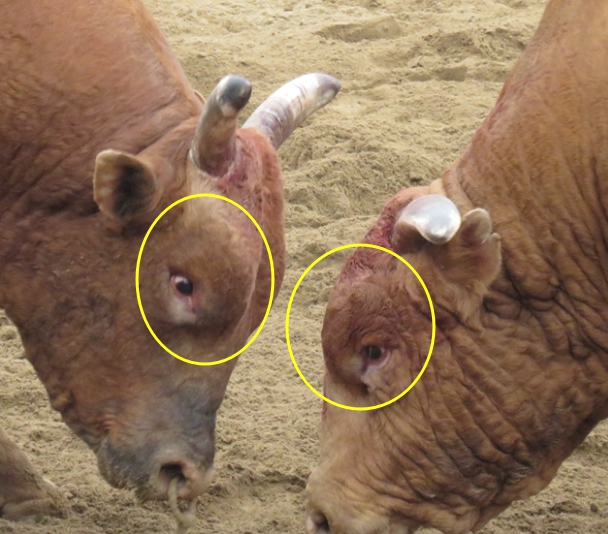 "아이홀뼈가 튀어나와서 보기 싫어요. " 아이홀뼈 절삭에 관하여 성형외과 전문의가 설명드립니다. 관련 이미지 2