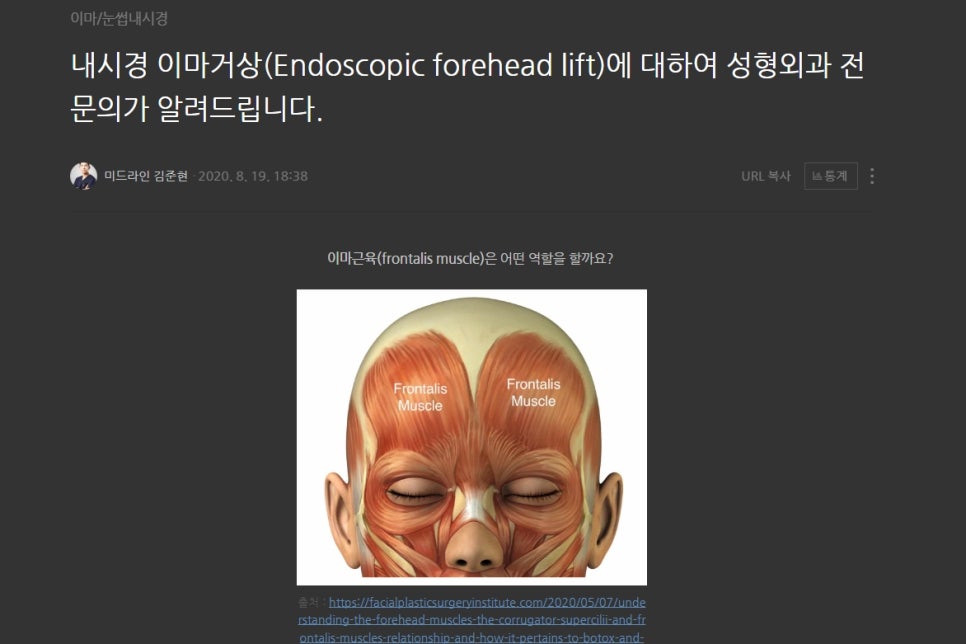When Should Endoscopic Forehead Lift and Brow Lift Be Performed at the Same Time? (Feat. Lower Blepharoplasty) image 1