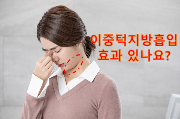 이중턱 지방흡입의 효과에 대하여 전문의가 알려드립니다. 관련 이미지 3