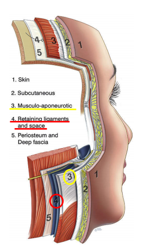안면거상(Face lift, Rhytidectomy)에 대하여 성형외과 전문의가 알려드립니다. 관련 이미지 5