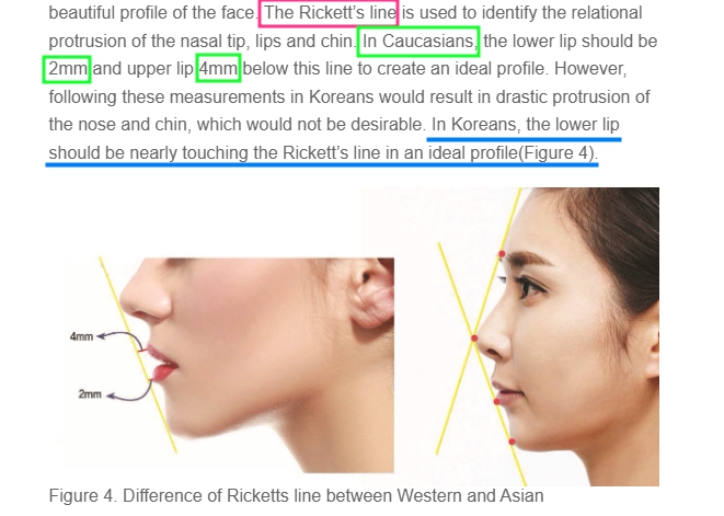 마녀턱이 싫어요ㅠㅠ턱이 들어갔으면 좋겠어요..턱끝후진술에 대하여 성형외과 전문의가 설명드립니다. 관련 이미지 6