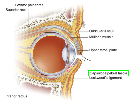 What Type of Plastic Surgery Is Needed for Small, Cramped Eyes? (About Lateral, Lower, and Combined Lateral-Lower Canthoplasty) image 16