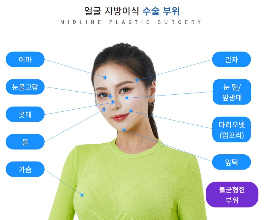 Sallow Eyes, Sunken Eyes Solved with Fat Grafting! (Feat. Dark Circles) image 13